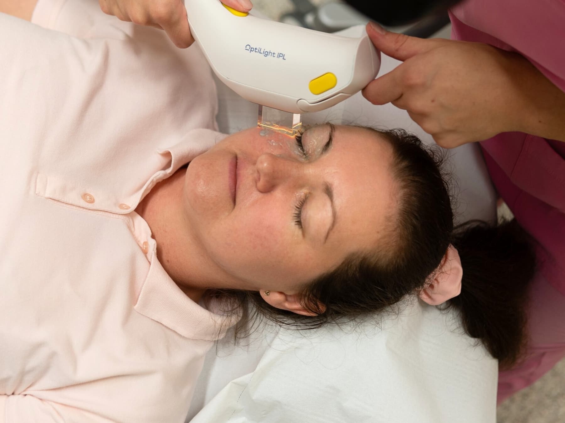 OptiLight o LipiFlow? Come tratto oggi la sindrome dell’occhio secco 