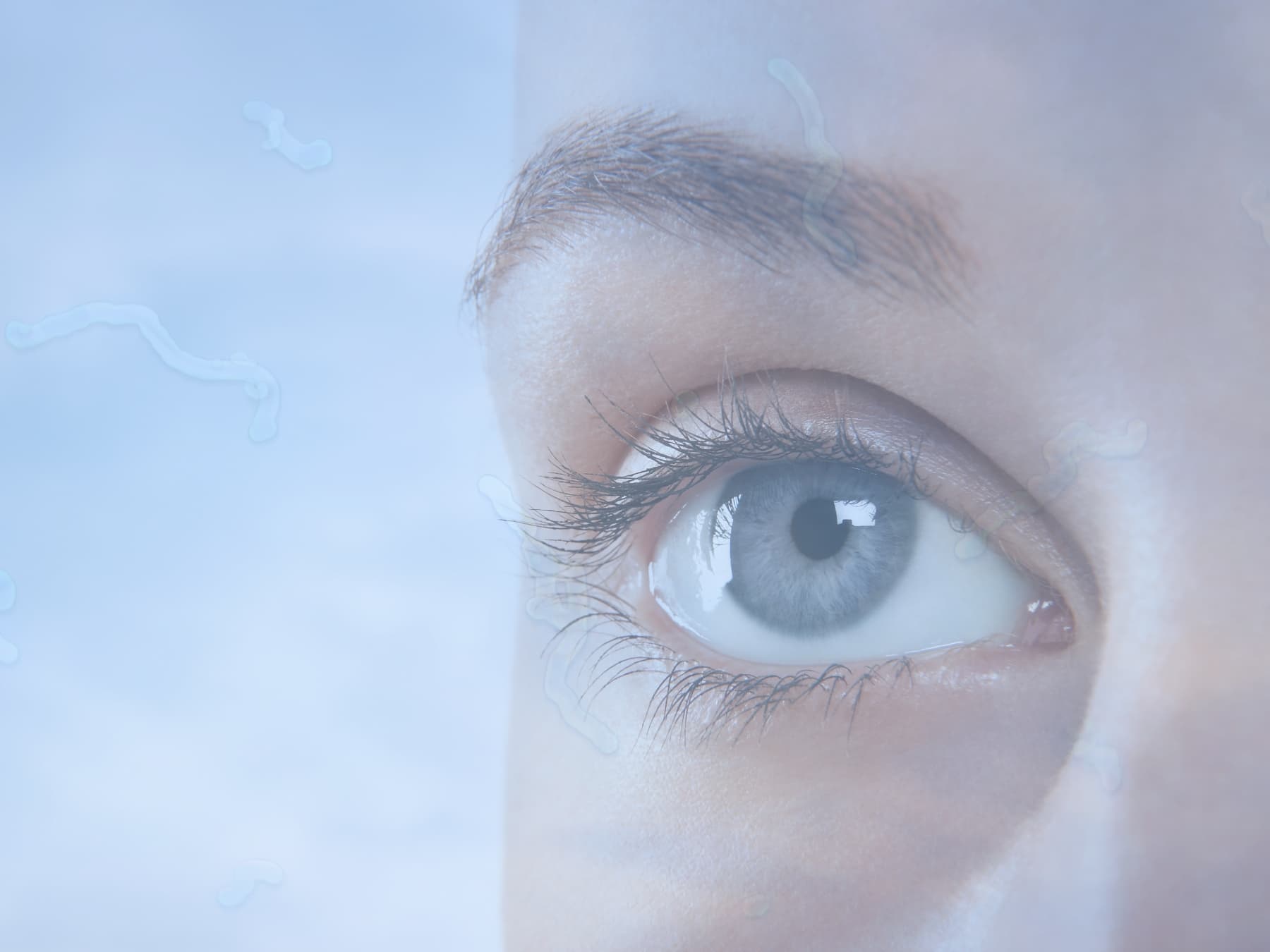 Quando consiglio la rimozione laser delle opacità vitreali nell’occhio? 